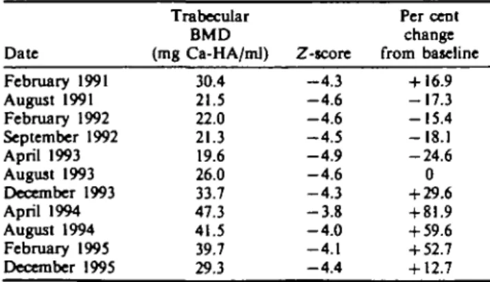 TABLE II