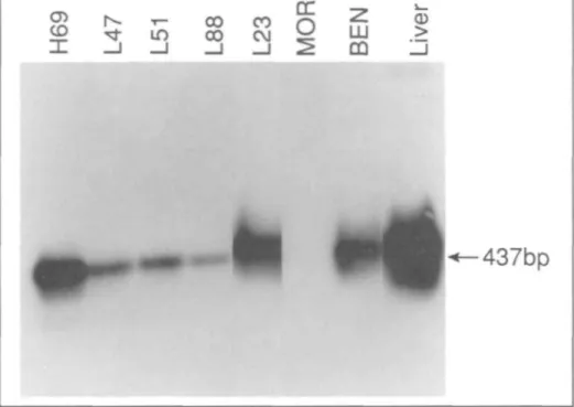Fig. 1. Detection of IGFBP-1 gene expression in SCLC and NSCLC cell lines by RT-PCR and Southern blotting, followed by hybridization with a 1.2-kb radiolabeled IGFBP-1 cDNA probe (clone w85).