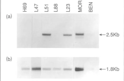 Fig. 3. Northern blot analysis of IGFBP-3 gene expression in SCLC and NSCLC cell lines (panel a)