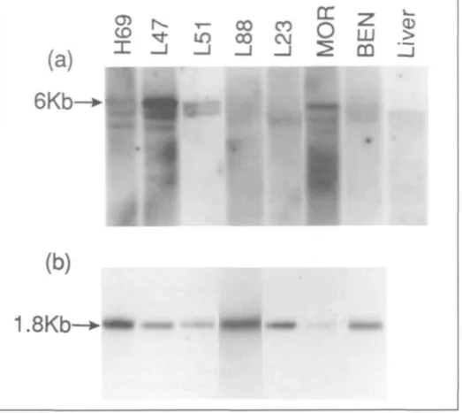 Fig. 5. IGF-II gene expression in SCLC and NSCLC cell lines detected using the 1.1 -kb phigf-II cDNA probe and Northern blot analysis (panel a)