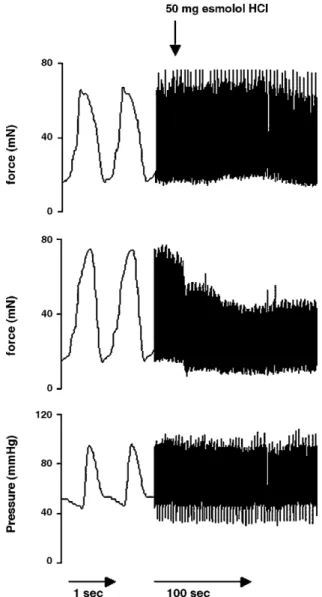 Fig. 3. A recording under control conditions from the second patient of our first cohort, showing the unloading type of contractile force recorded from some tangentially aggregated myocytes (upper trace), the auxotonic type of forces recorded from the myoc