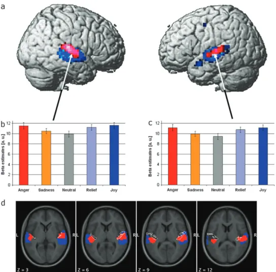 Figure 1. (a) Overlap of activation selective to voices (temporal voice area, TVA: voices [ animal and ES, blue) and activation selective to emotional prosody (emotional voice area, EVA: emotional [ neutral prosody, red) rendered on a standard brain templa