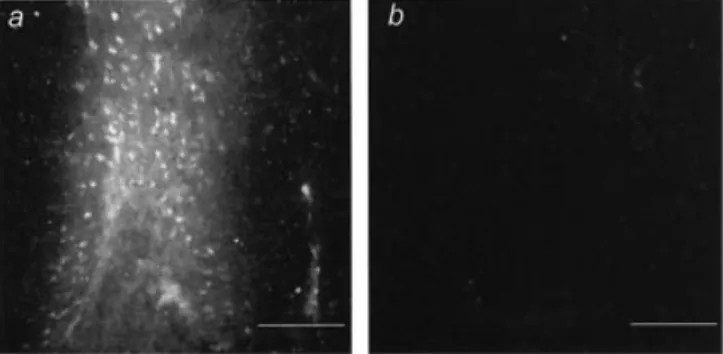 Fig. 6 Expression of MMP-9 and MMP-13 mRNA in rats treated with anti-IL-6 antibodies. Cerebral infection of rats with