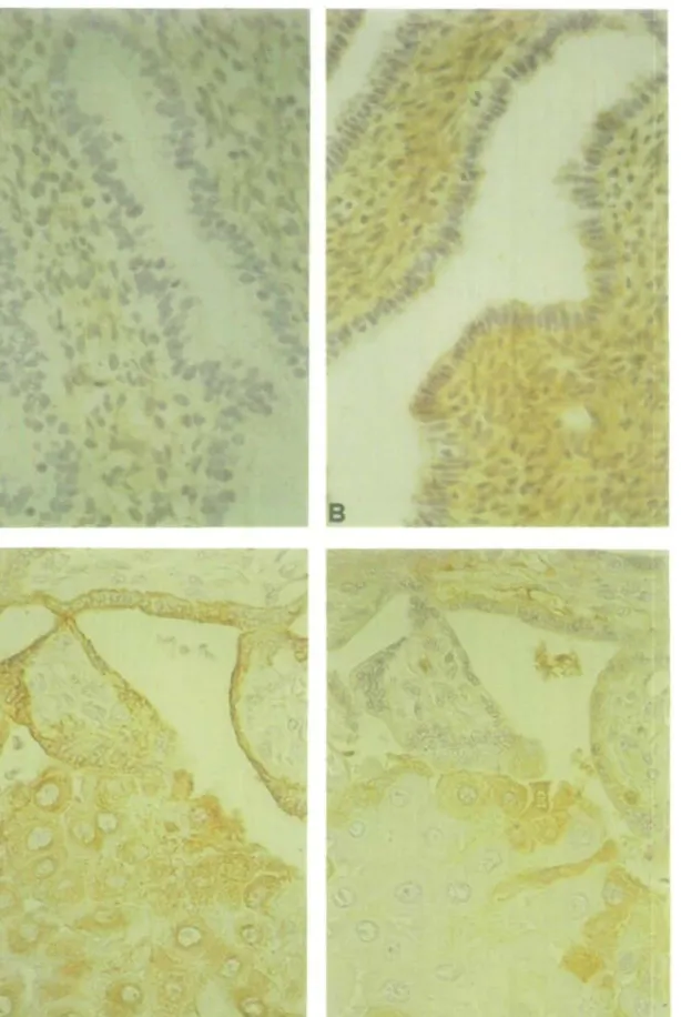 Fig. 1. Immunohistochemical distribution of C3 in a proliferative (A) and a secretory endometrium (B) and of cytokeratin (C) and C3 (D) in the implantation site of an 11 week pregnancy