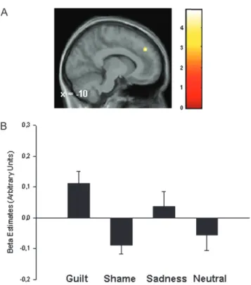 Figure 3. Guilt-specific processing in the paracingulate region of the DMPFC. (A) Activation for guilt compared with the 2 control emotions, shame and sadness (Guilt[ Shame þ Sadness)