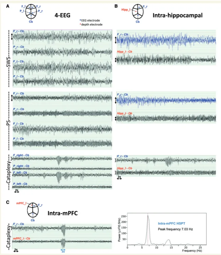 Figure 9 CAS and HSPT activities of OX ko/ko mice are not hippocampal. Shown are surface (EEG) and depth potential recordings in OX ko/ko mice carrying electrodes in various locations