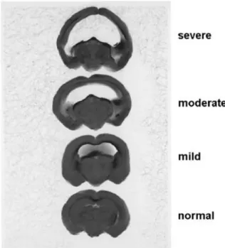 Figure 1 Brain sections of golden hamsters without hydrocephalus (normal) and with mild, moderate, and severe hydrocephalus.
