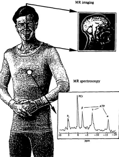 Fig. 1. Magnetic resonance imaging (MRI) and magnetic resonance spectroscopy (MRS).