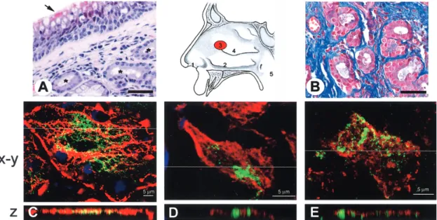 Figure 2. Histological location and immunohistochemical detection of Staphylococcus aureus (center)