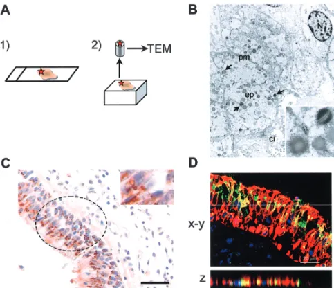Figure 3. Presence of Staphylococcus aureus in epithelial cells of nasal epithelium, evaluated by transmission electron microscopy (TEM) (arrows;