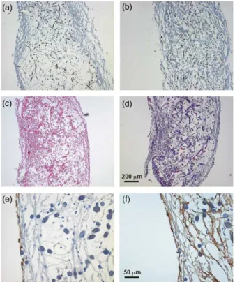 Fig. 3. Extracellular matrix analysis. HYP, hydroxyproline; GAG, sulfated glycosamino glycans; DNA, deoxy nucleic acid (cell number)