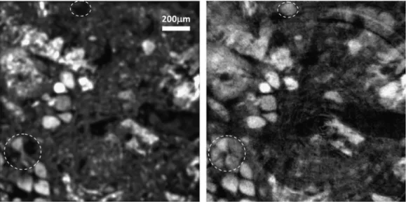 Figure 7 shows a comparison between the porosity maps determined using DCM and xenon K-edge subtraction