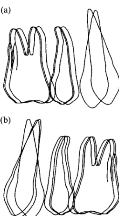 Figure 5 Composite tracings of the median positions of the teeth on the recent extraction side (a) at times T2 and T3 (canine) and Tl, T2 and T3 (premolar and molar) and on the healed side (b) at times Tl, T2 and T3