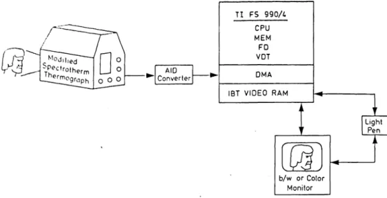 Figure 2. Block diagram of the microprocessor-assisted thermography System. CPU - central processor unit; MEM  Computer memory; FD  floppy disc unit; VDT  video terminal; DMA  -direct memory access board; IBT VIDEO RAM - display refresh memory developed at