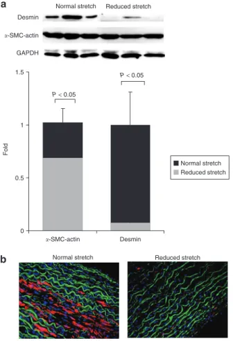 Figure 3 | Matrix metalloproteinase (MMP) expression. (a) The effect of cyclic  stretch on MMP-2 protein expression, visualized by immunoblotting