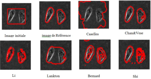 Figure 4.5: Résultats de Segmentation pour l’Image test: TwoCells_ Microscopy image