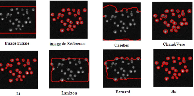 Figure 4.6: Résultats de Segmentation pour l’Image test : Yeast_FluorescenceMicrograph