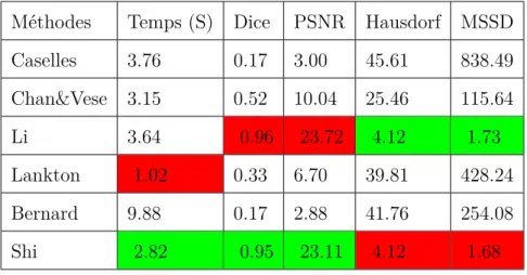 Table 4.3: Performances des Méthodes de Segmentation en terme de Temps, Dice, PSNR, Hausdorff et MSSD pour la Segmentation d’Image Réelle (Monkey)