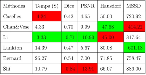 Table 4.4: Performances des Méthodes de Segmentation en terme de Temps, Dice, PSNR, Hausdorff et MSSD pour la Segmentation d’Image Réelle (Statue)