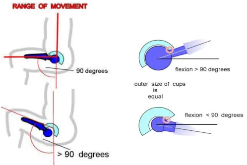 Fig. I.18 : La règle de 90 degrés, b) flexion suivant diamètres de têtes fémorales [Ch
