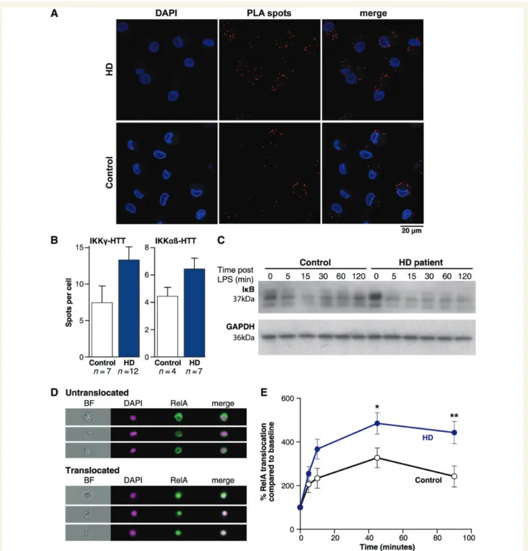 Figure 5 HTT interacts directly with the NFkB pathway, which is dysregulated in Huntington’s disease (HD)