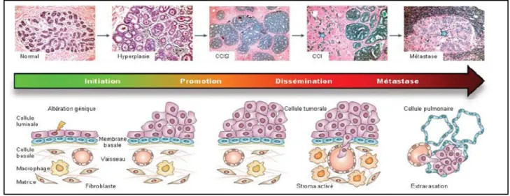 Figure 6. Les étapes de la cancérisation mammaire. 