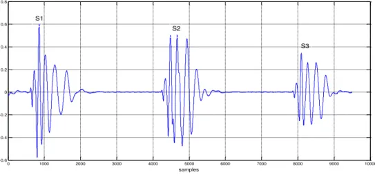 Fig. I.10 .Représentation d’un cycle cardiaque contenant le signal (S4)