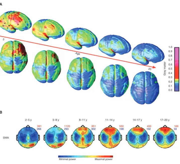 Figure 3 Brain maturation and SWA topography.