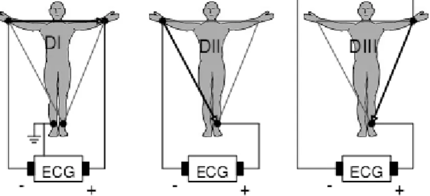 Fig. 2.5 Montage d‟Einthoven pour l‟enregistrement des dérivations bipolaires des membres
