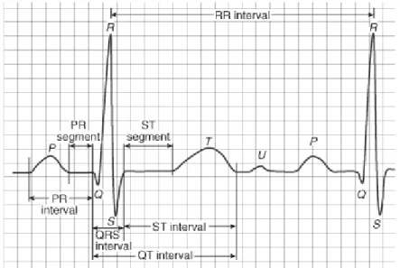 Fig. 2.9 Étapes successives de dépolarisation/repolarisation du cœur qui se traduisent sur  le plan électrocardiographique par différentes ondes P, QRS, et T