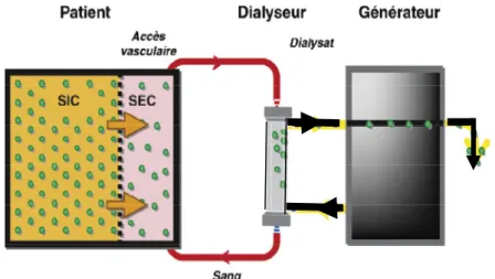 Figure 3.1 : Épuration extra rénale par hémodialyse [105]. 