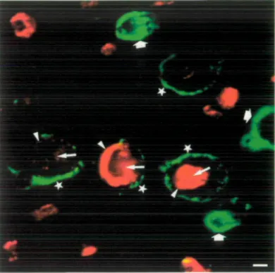 Fig. 4 Photomicrograph of a peroneal nerve biopsy from Patient Bo 12. Double-immunofluorescence staining with D3A2G5  anti-MAG mAb (red label) and human IgM deposits (green label).