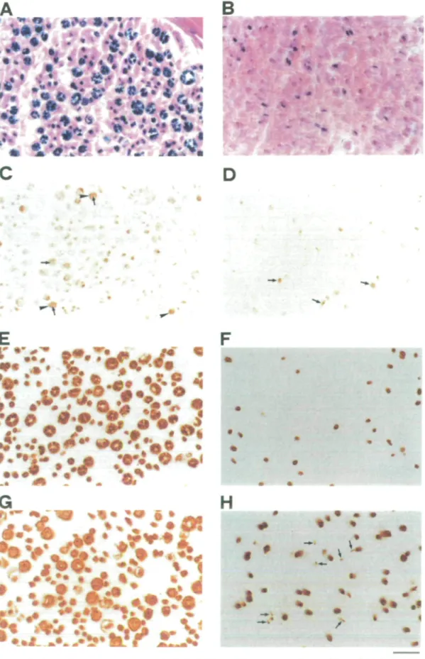 Fig. 1 Photomicrograph of a control sura] nerve (A, C, E, G, I, K. M and CX) or a peroneal nerve biopsy from Patient Bo 9 (B