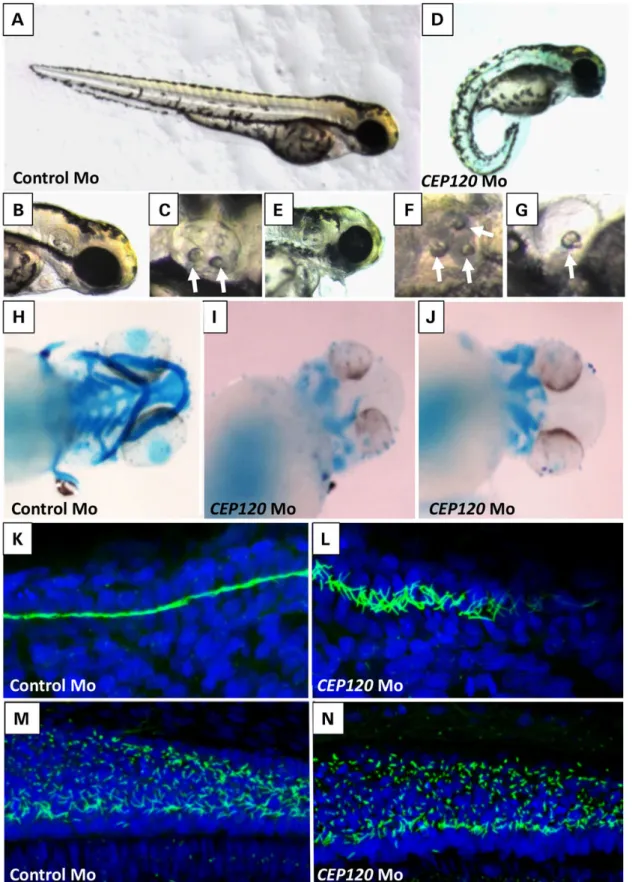 Figure 4. Knockdown CEP120ortholog in ZF results in typical ciliopathies associated phenotypes in ZF