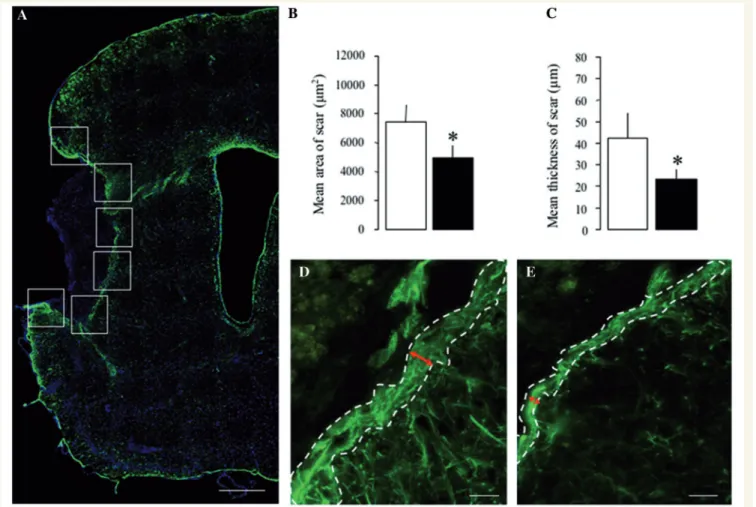 Figure 6 Reduction of astroglial scar formation. Quantitative analysis of the GFAP + astroglial scar area (A) and thickness (B) along the ischaemic border zone