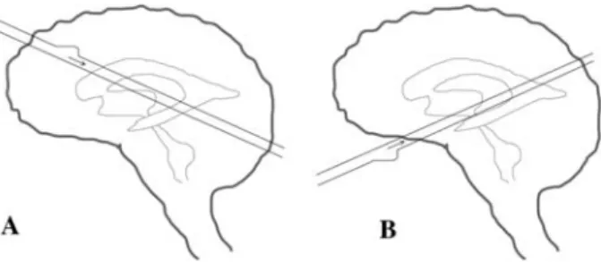 Figure 11 Sketch of how the cerebrospinal fluid may be driven by brain motion to explain the phase differences.