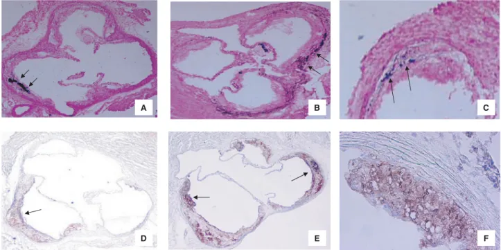 Fig. 1. (A–C) Extent and localization of different types of atherosclerotic lesion calcification in apoE −/− mice without CRF receiving standard diet or in apoE −/− mice with CRF receiving either CaCO3 supplemented diet or standard control diet