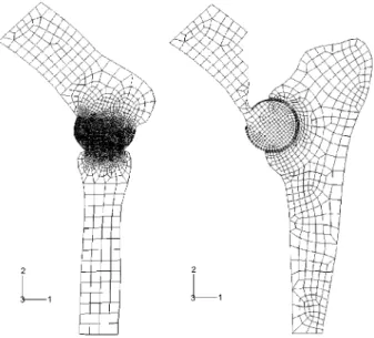 Abbildung 4 FE-Modelle der zwei Humerus-Artikulationen: mit der Ulna rechts und mit dem Radius links.