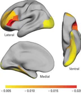 Fig. 1. The eﬀect of increasing number of obstetric complications (OCs) on average local gyriﬁcation in pre-deﬁned cortical areas in the left hemisphere signiﬁcant at p<0.05, from the linear regression model with age, diagnosis, gender and continuous OC