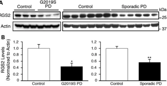 Figure 8. Levels of RGS2 are reduced in mutant G2019S LRRK2 and sporadic PD brains. Immunoblots of endogenous RGS2 levels in caudate striatal lysates from human G2019S LRRK2 PD patients and neurologic controls (A) or human sporadic PD patients and neurolog
