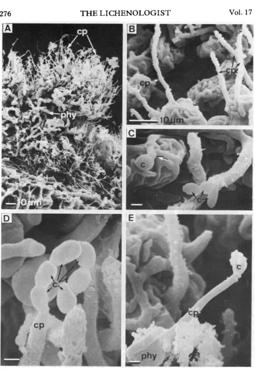 FIG. 2. SEM of thallus morphology and conidiophore structure in the symbiotic (freeliving) state of Coniocyte furfuracea