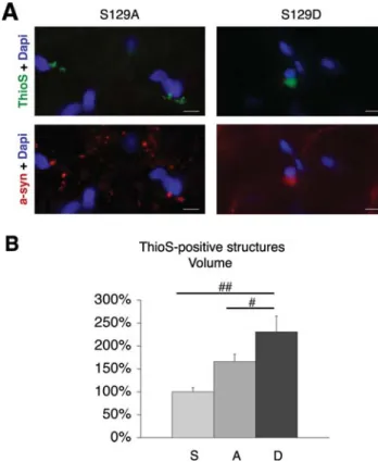 Figure 5. Condensation and lobulation of the a-syn-positive neuronal nuclei.