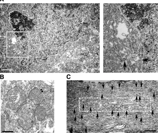 Figure 6. IEM demonstrating labeling of the Golgi apparatus, mitochondria and neurofilaments