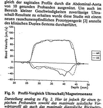 Fig. 3: Profile von Herzpatienten a) HOCM, b) AI Darstellung wie in Fig. 2 Messort: aufsteigende Aorta, Messzeitpunkt: 30% Austreibzeit