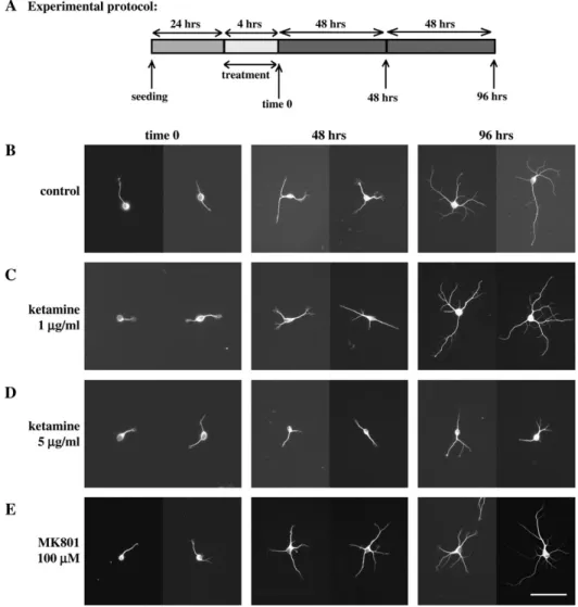 FIG. 3. Effects of short-term (4 h) ketamine and MK 801 treatment on subsequent dendritic development