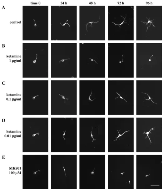 FIG. 6. Effect of long-term ketamine and MK 801 treatment on dendritic development. Twenty-four hours after seeding (time 0), ketamine was applied to the culture medium and left there for up to 96 h