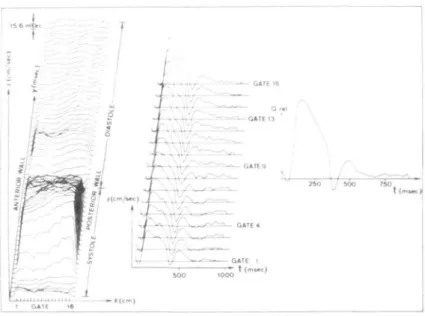 Figure 3 Velocity patterns in the ascending aorta. The plot of the results contains the full set of velocity profiles of a 30-year-old healthy female subject on the left side