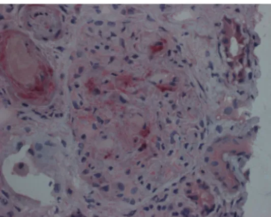 Fig. 4. Negative control: unspecific staining of parts of brush border in proximal tubules.