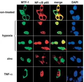 Figure 4 Hypoxia induces nuclear translocation of MTF-1 and NF-kB p65.