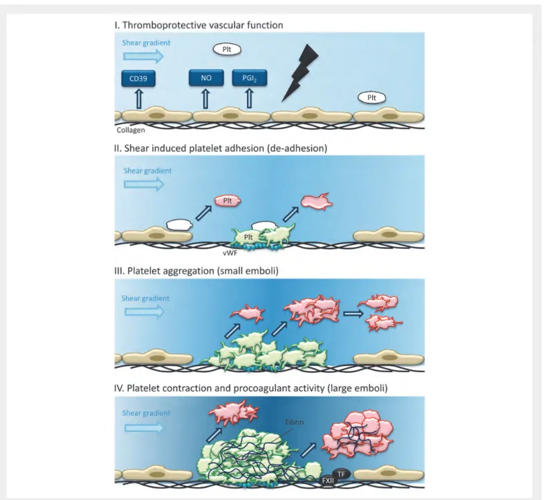 Figure 1 Thrombus growth and instability in a damaged artery. (I) Endothelial activity at the healthy vessel wall prevents platelet (Plt) adhesion